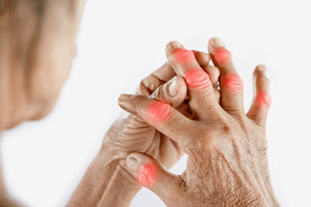 Rheumatoide Arthritis Titelbild V2