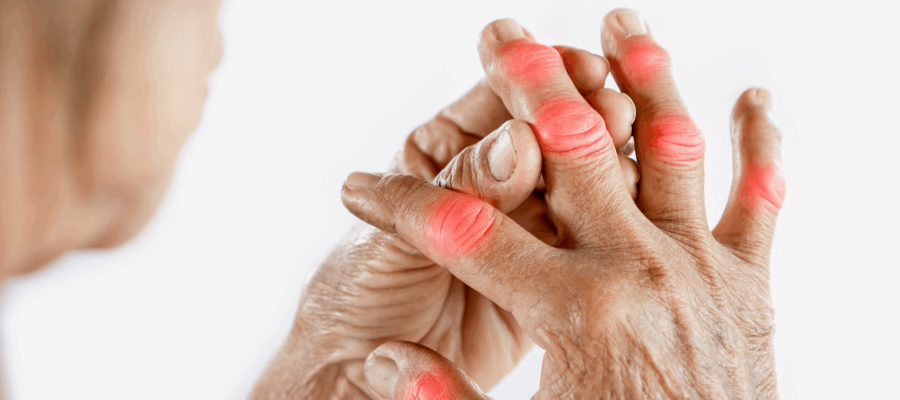 Rheumatoide Arthritis_Titelbild_V2 Rheumatoide Arthritis_Titelbild_V2